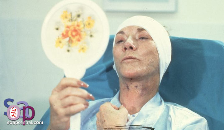 Katherine sees the results of her facelift